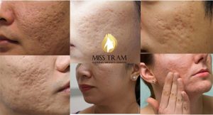 Thẩm mỹ viện Miss Trâm