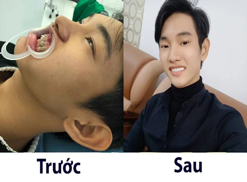 Khách hàng trước và sau khi sử dụng dịch vụ tại Titan