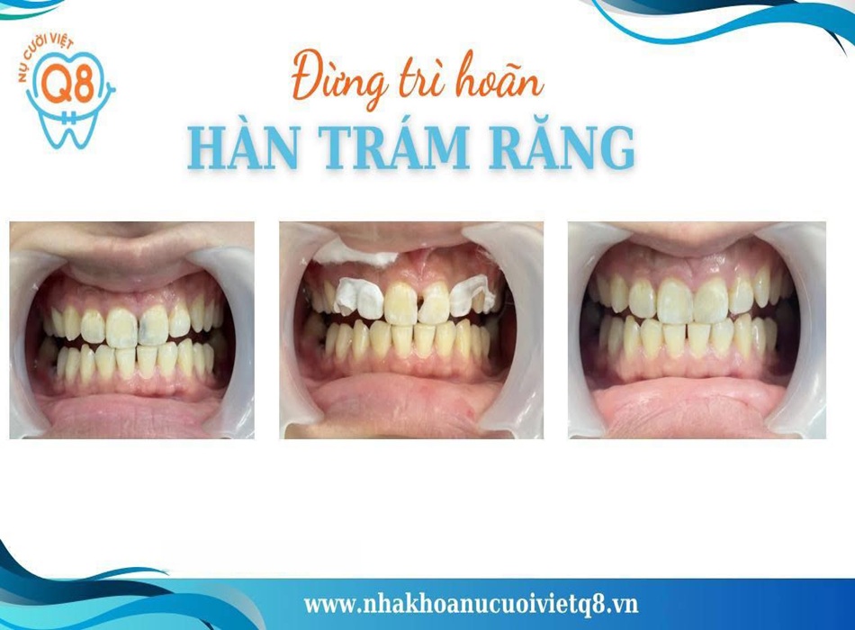 Nha Khoa Nụ Cười Việt Q8 cung cấp các dịch vụ nha khoa chuyên sâu