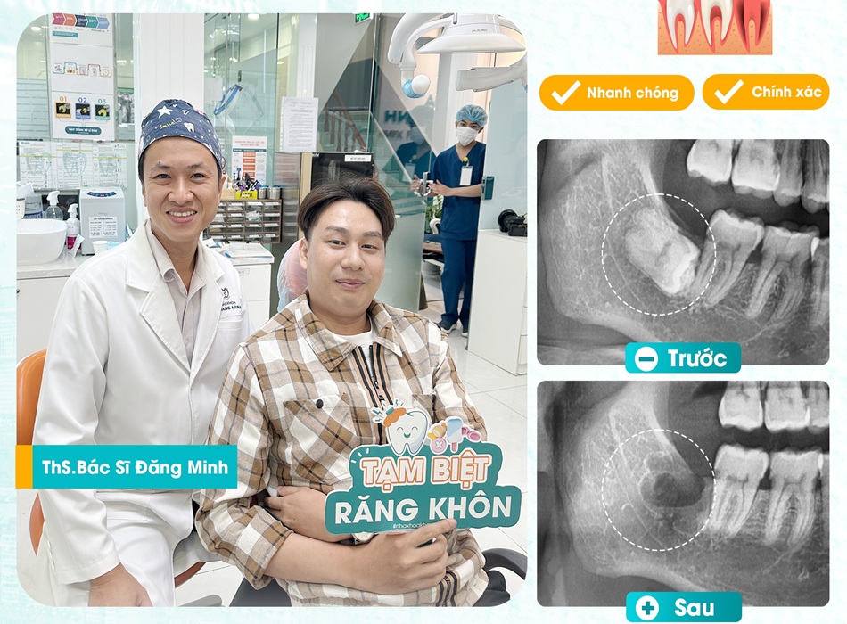 Nha khoa Khang Minh cung cấp đa dạng dịch vụ từ cơ bản cho đến chuyên sâu
