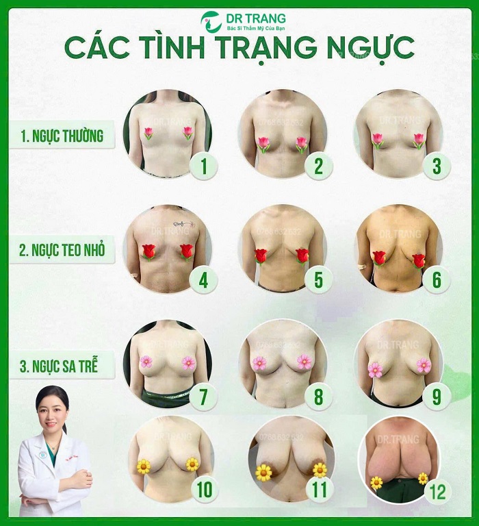 TS.BS Cái Hữu Ngọc Thảo Trang (TS Trang TARA) – Chuyên gia phẫu thuật nâng ngực, treo ngực