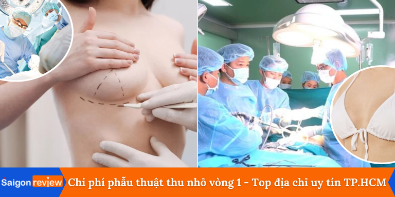 Chi phí phẫu thuật thu nhỏ vòng 1 – Top 8 địa chỉ uy tín TP.HCM Chi phí phẫu thuật thu nhỏ vòng 1 – Top 8 địa chỉ uy tín TP.HCM