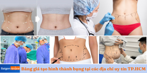 Bảng giá tạo hình thành bụng tại các địa chỉ uy tín TP.HCM