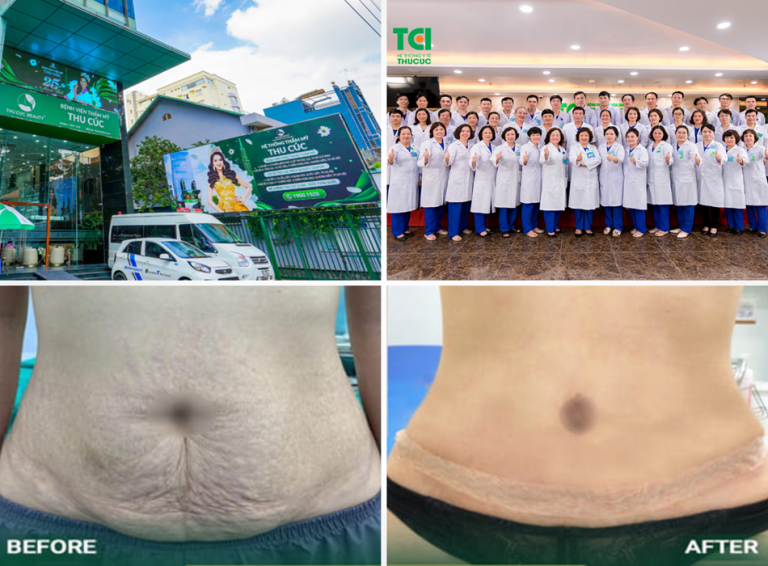 Bệnh viện Thẩm mỹ Thu Cúc Sài Gòn: Dịch vụ tạo hình thành bụng theo chuẩn an toàn y khoa